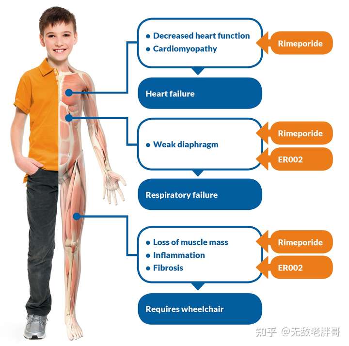 探索前沿：肌营养不良症领域的最新突破性药物研究